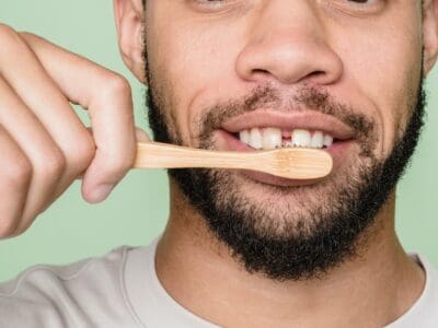 Close-up of tooth gap before cosmetic dental treatment at Widcombe Dental Practice