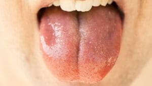 Mouth with its tongue out