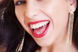 Example Smile After Widcombe Dentists In Bath