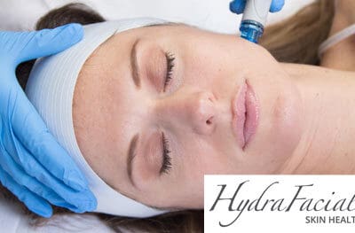 Woman receiving HydraFacial MD skin treatment at Widcombe Dental Practice Bath