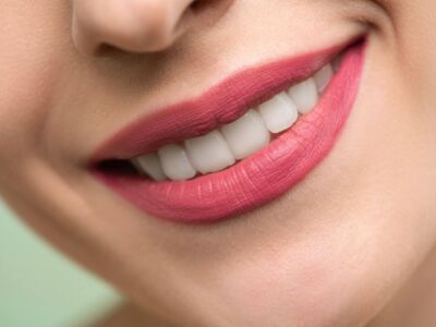 Smile Design