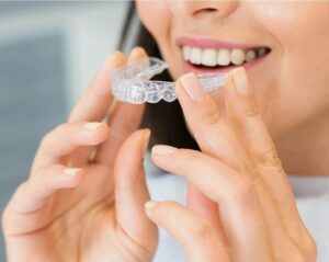 Invisalign treatment results from Widcombe Dental Practice Bath