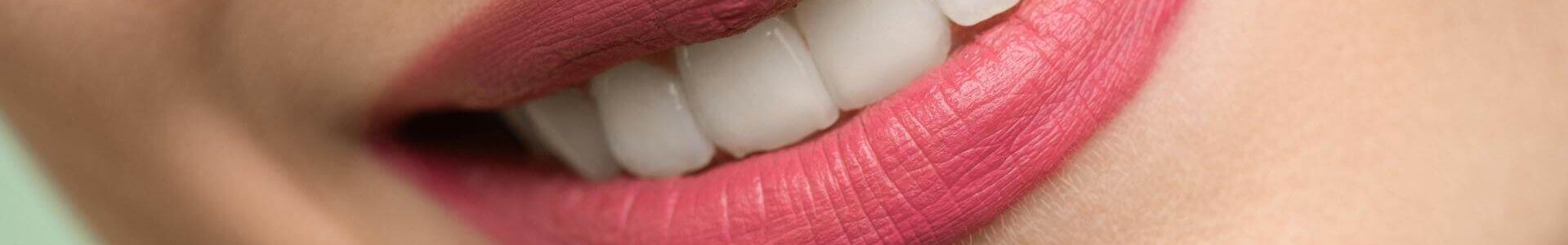 Woman smiling showing white teeth after dental bridge treatment